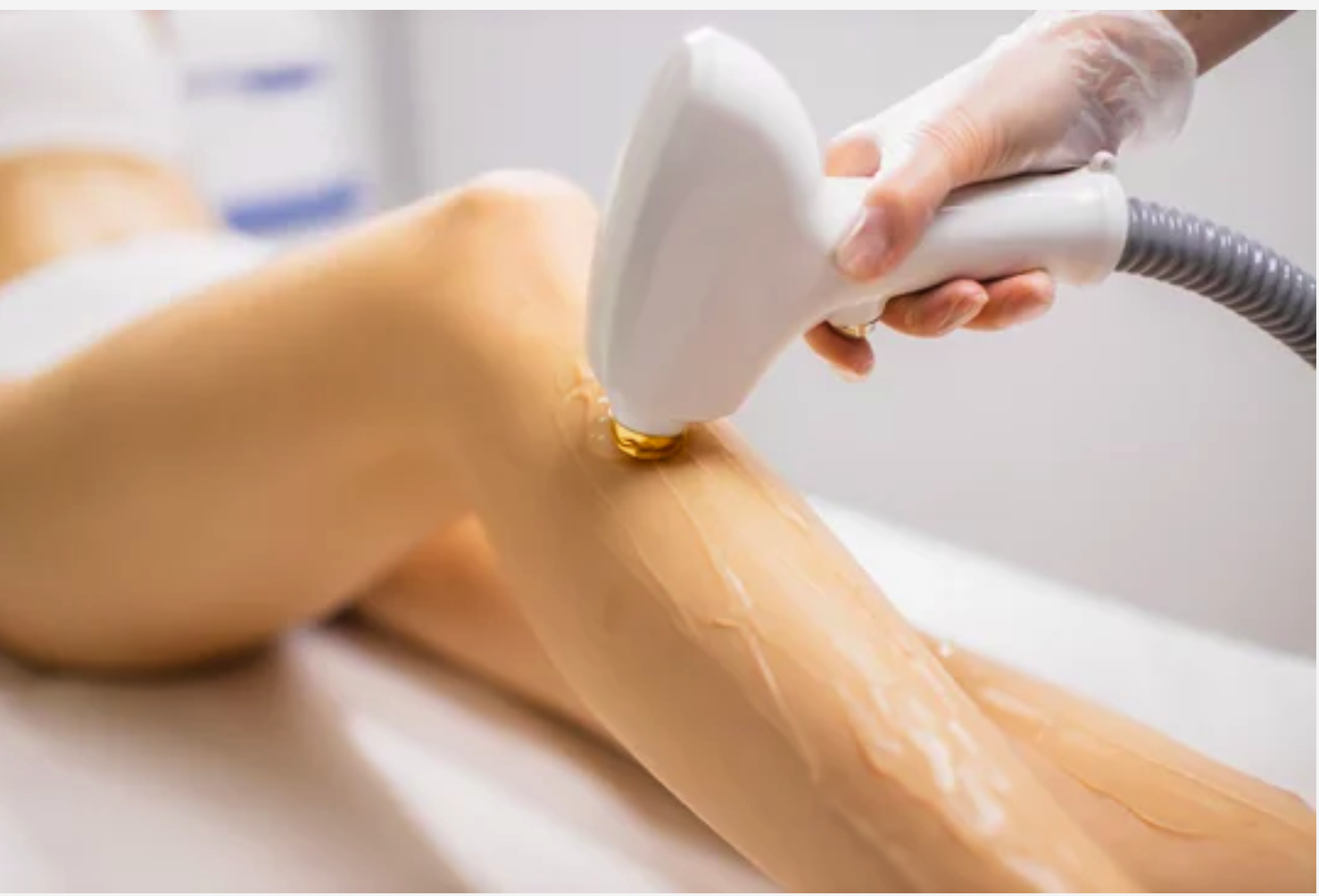 Laser Hair Removal