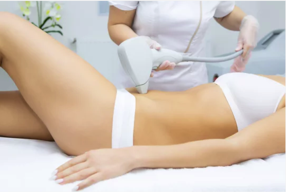 Abdomen (Women - Happy Trail)