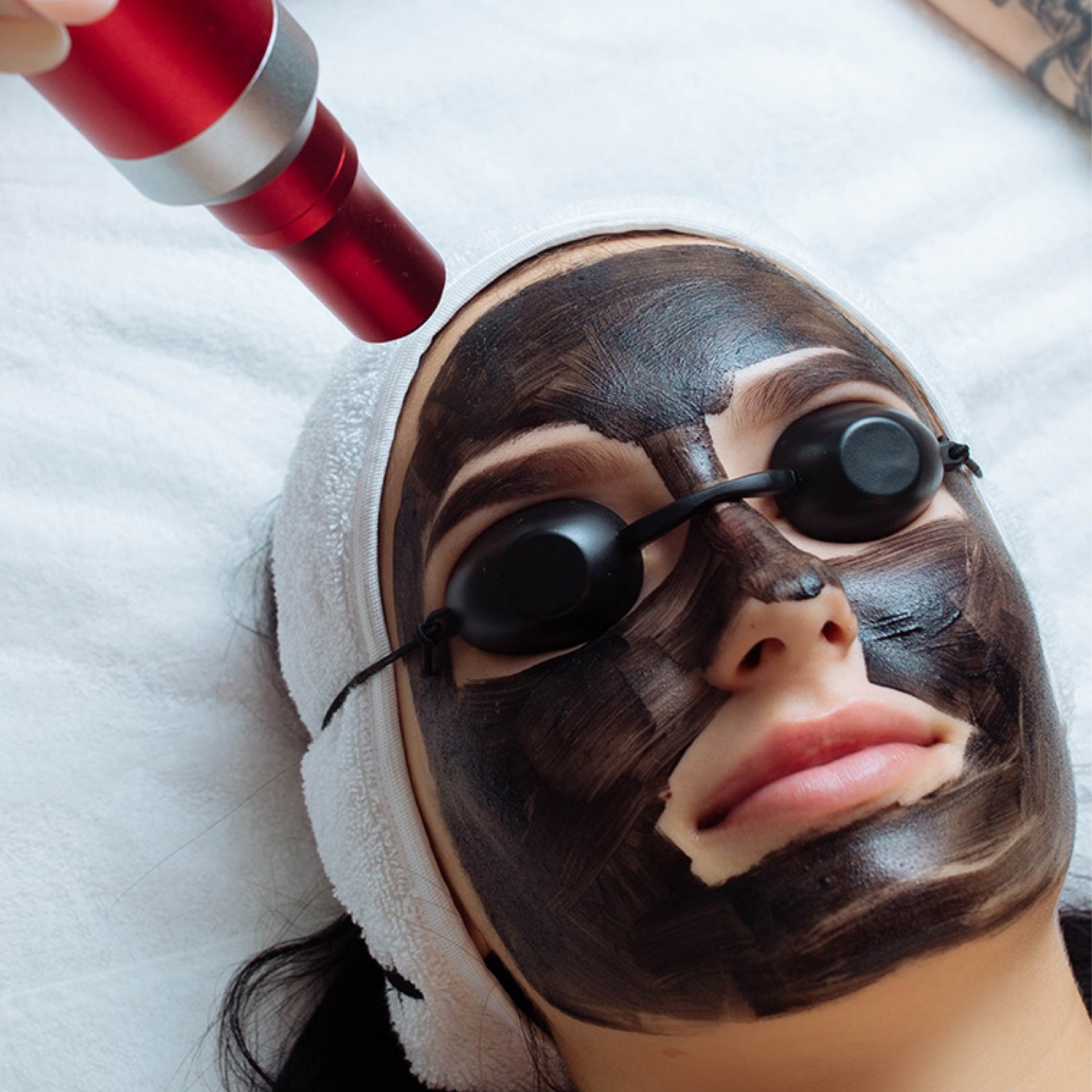 Carbon Peeling rostro en Gold Studio, Allentown, PA