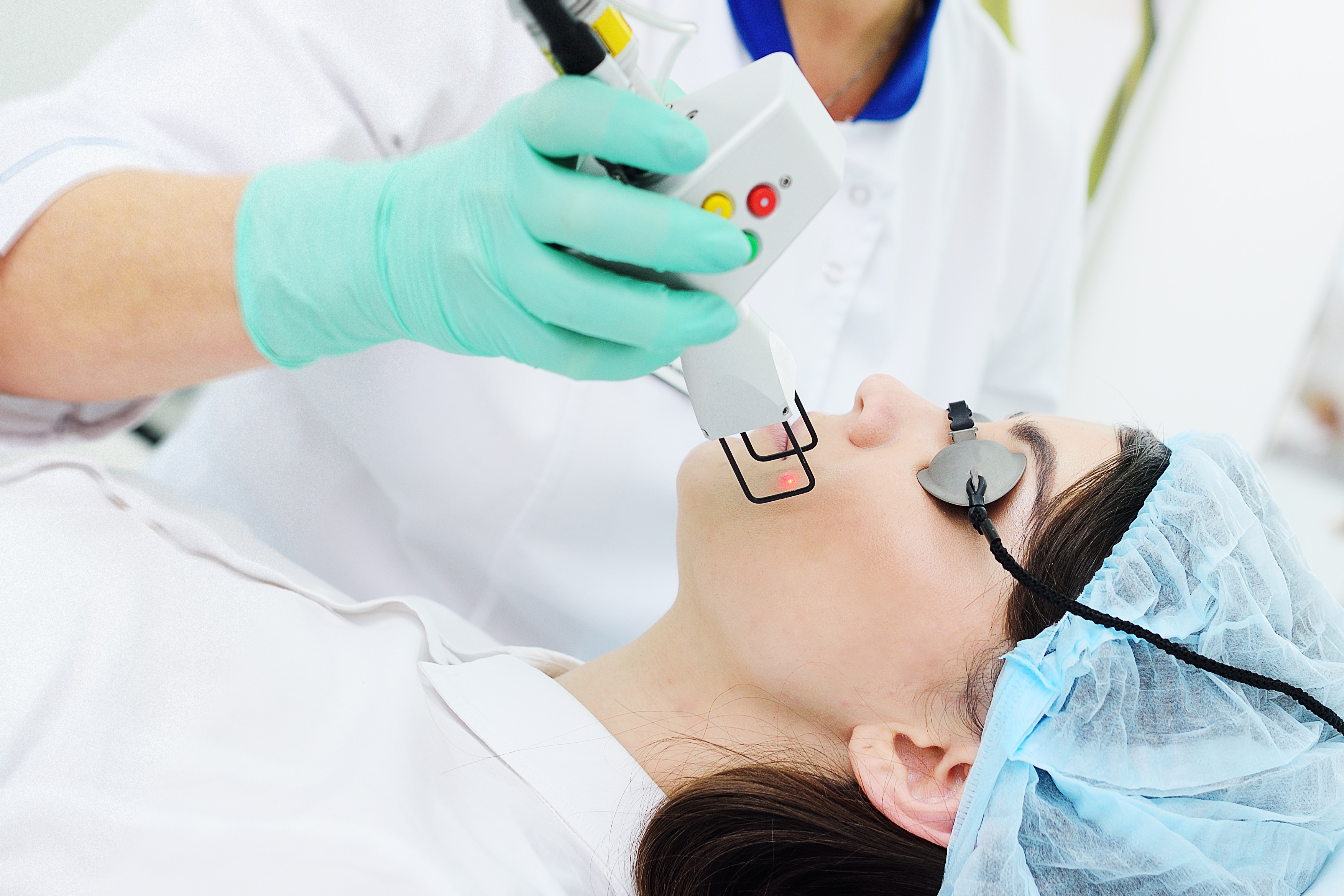CoolPeel® (CO₂) by DEKA