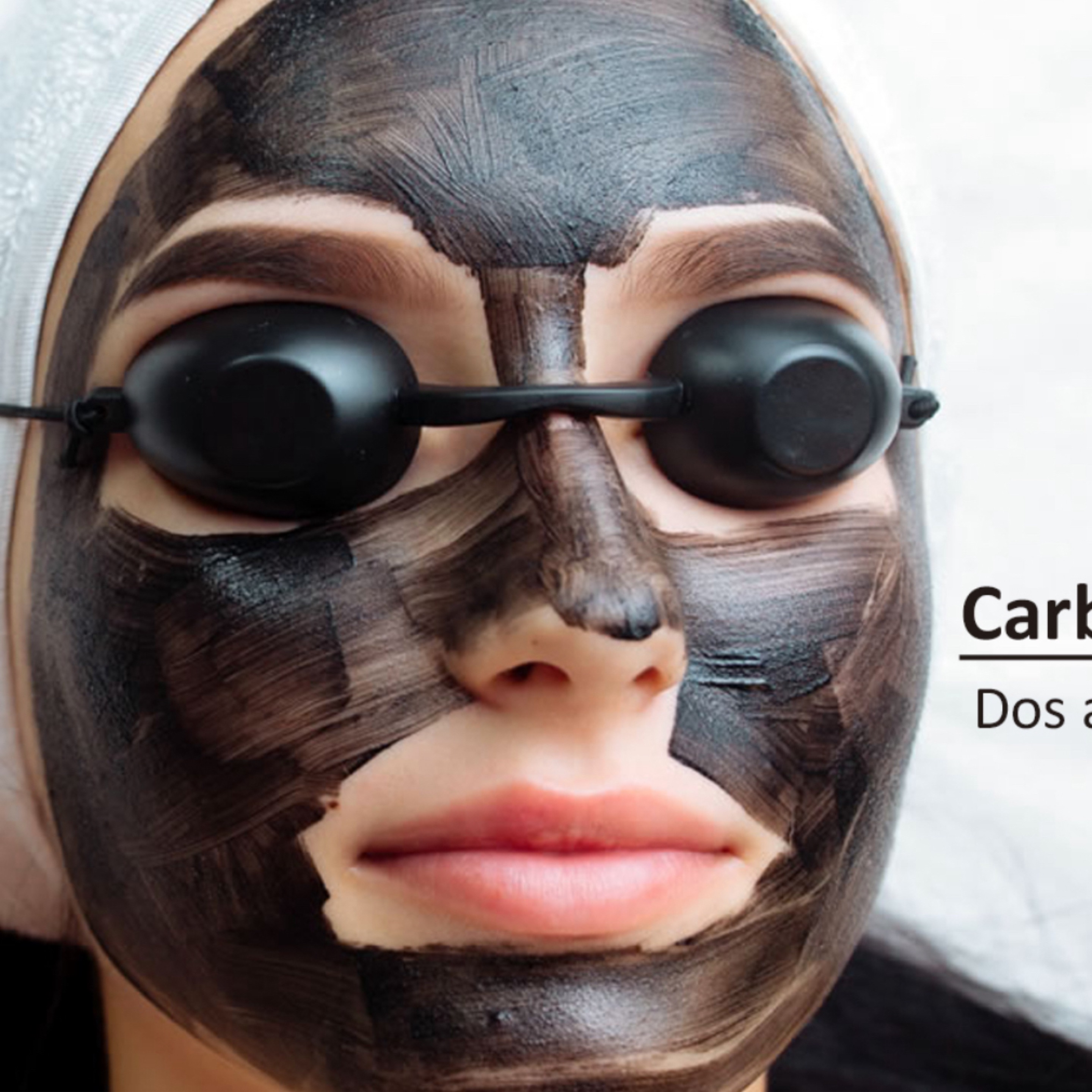 Carbon peeling 3x$280 en Gold Studio, Allentown, PA