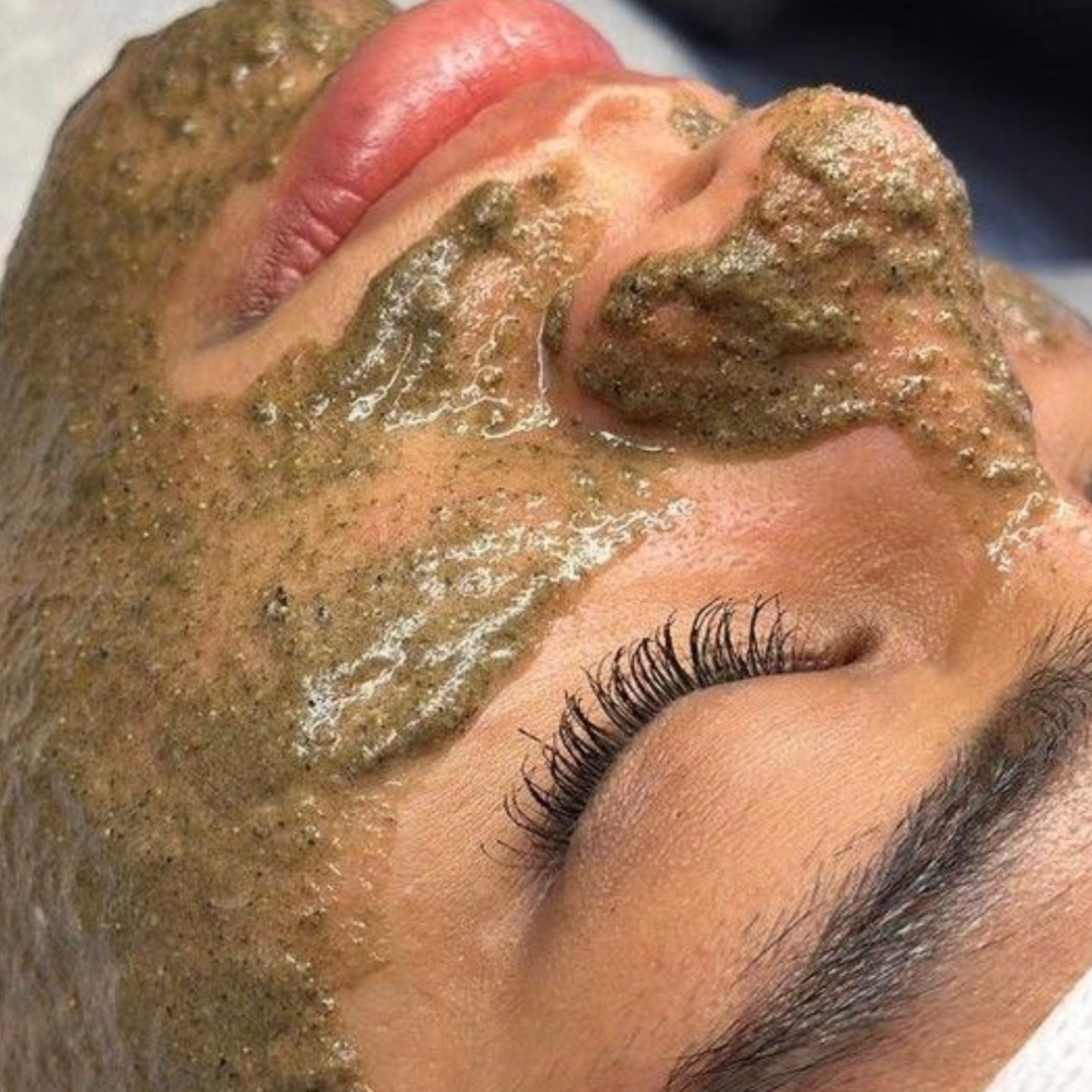 Marine Spicule Peel treatment in Calgary at MAesthetics Skin Atelier