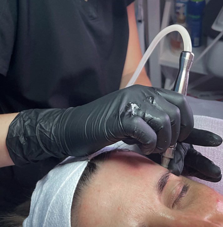 Facial - Microexfoliation ADD-ON