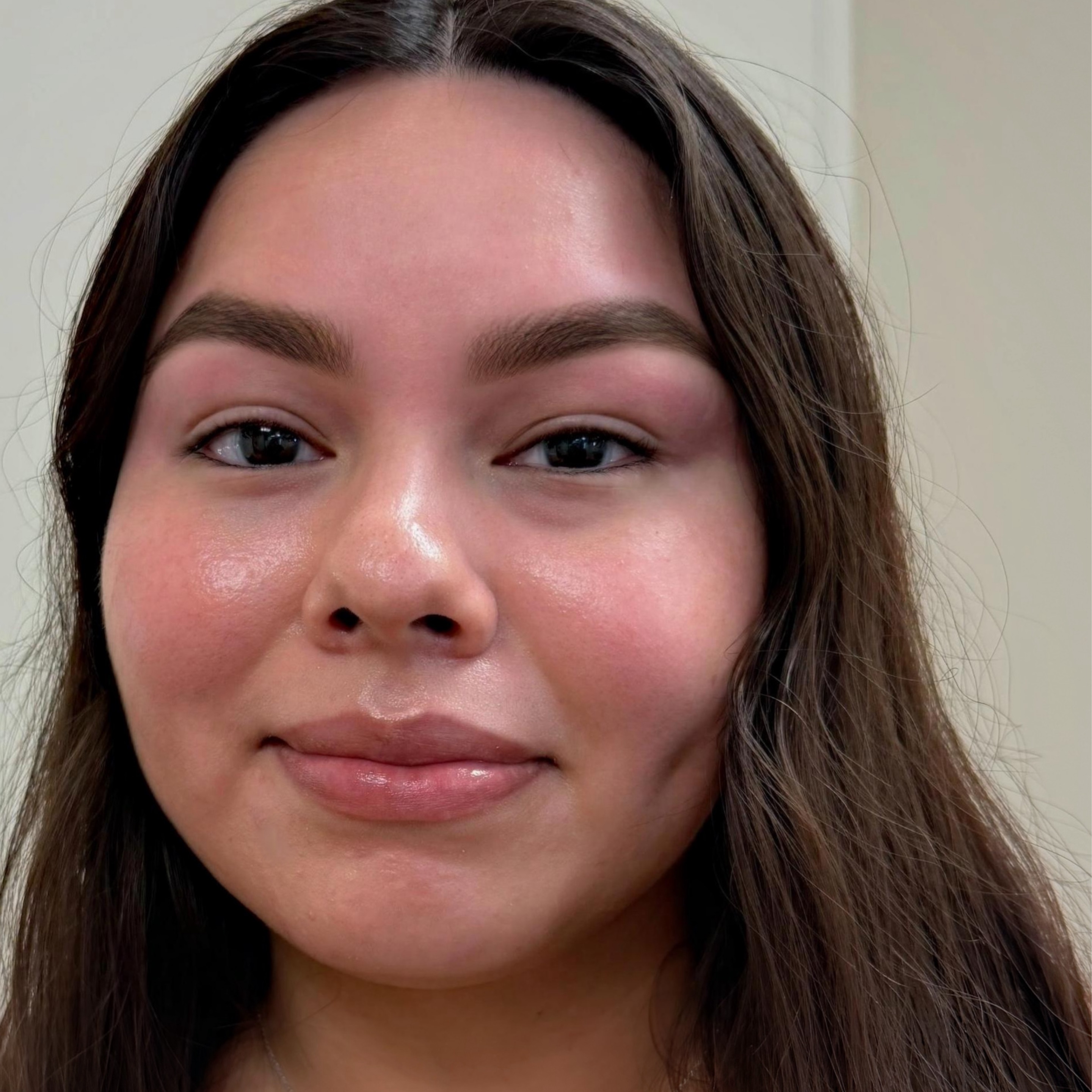 Brow rehab