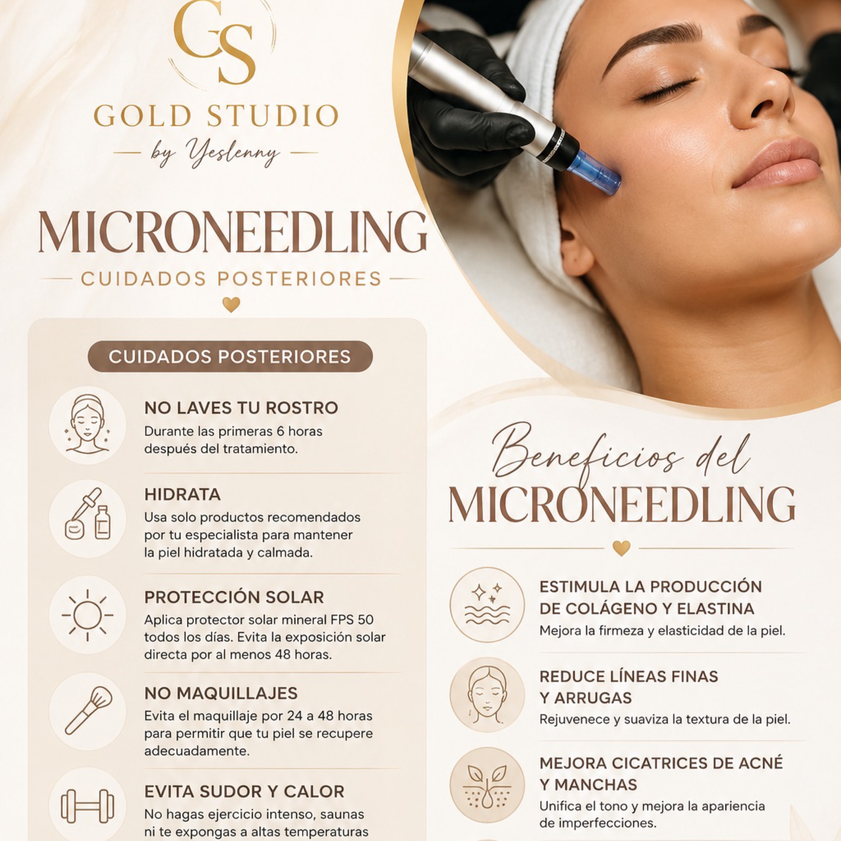 Microneedling 3x$390 en Gold Studio, Allentown, PA