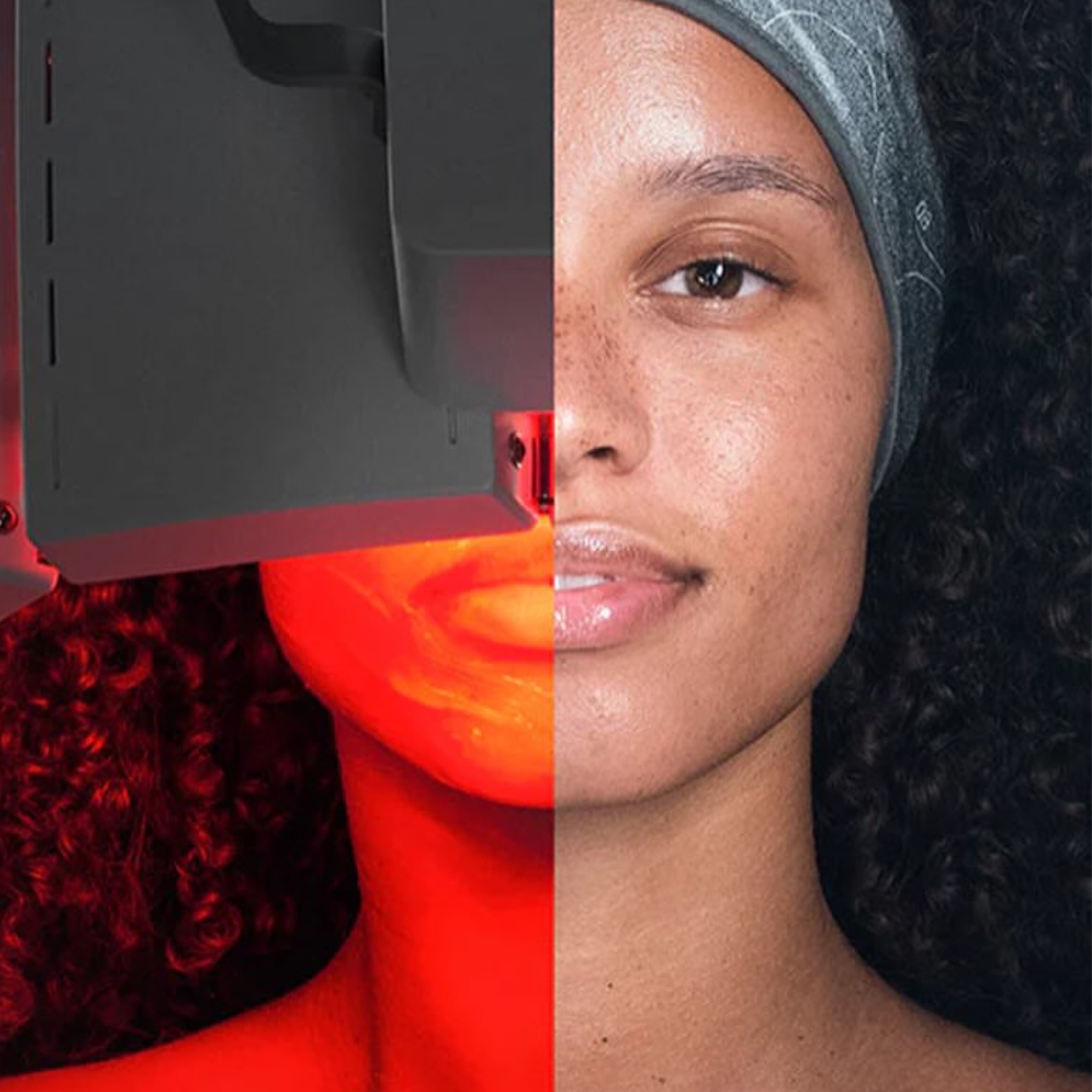 LUMINFUSION treatment in Calgary at MAesthetics Skin Atelier
