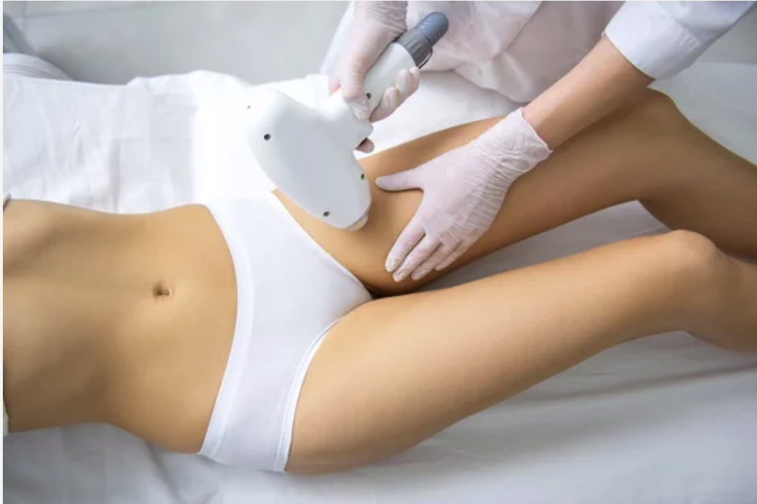 Legs (Full) Laser Hair Removal